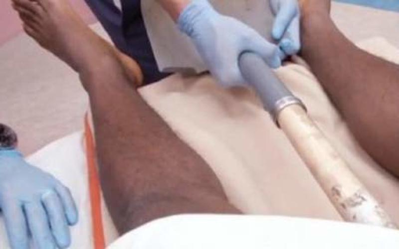 Il a un manche de pelle dans le rectum