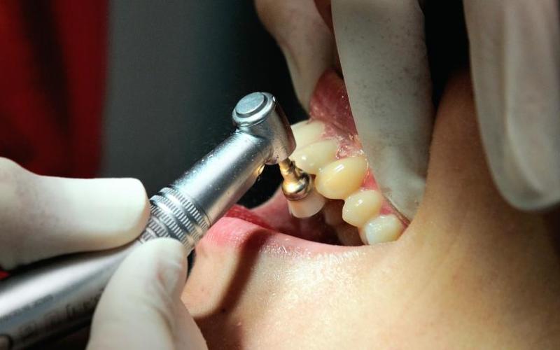 Nancy : Les étudiants en chirurgie dentaire ont une dent contre l'assurance maladie