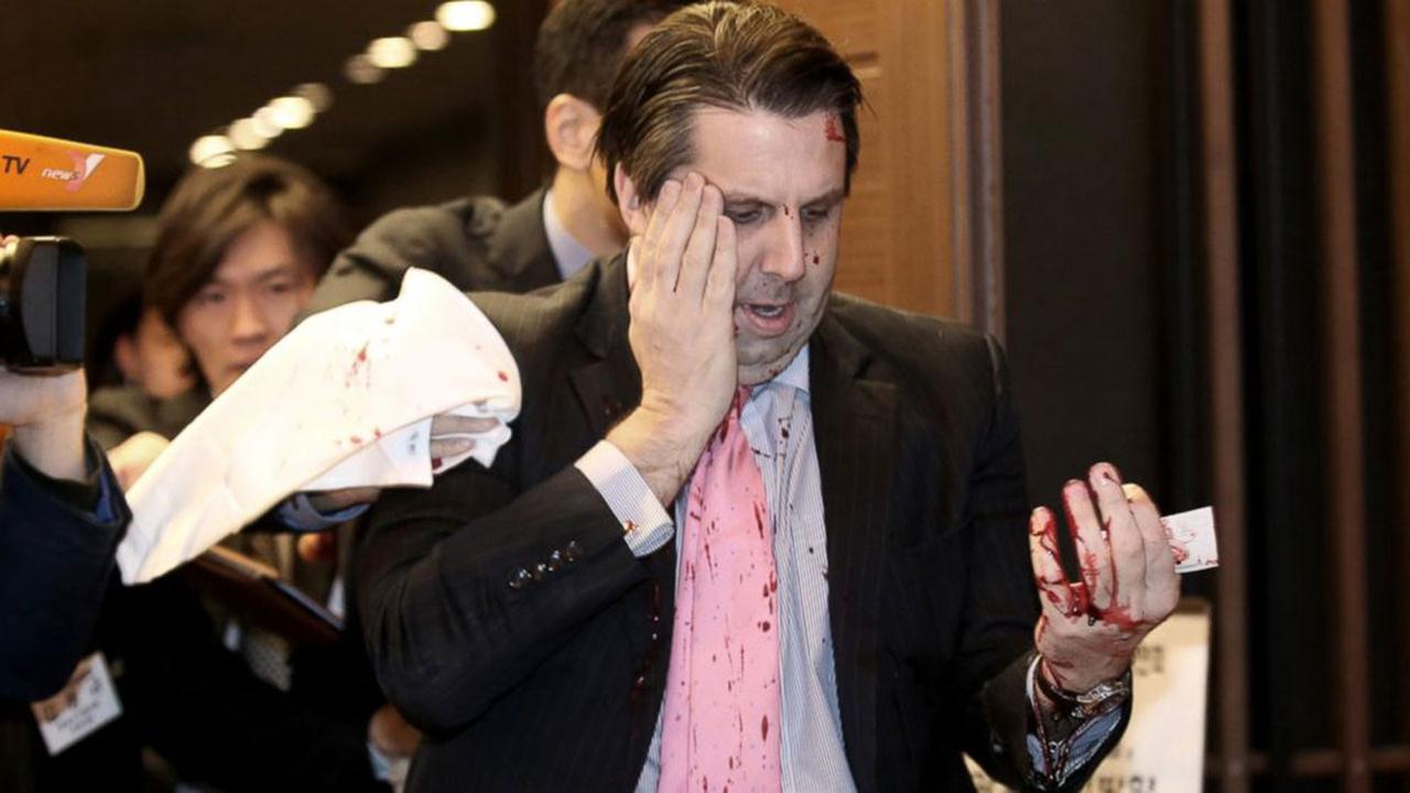 La Corée du Sud dénonce l'attaque de l'ambassadeur américain à Séoul