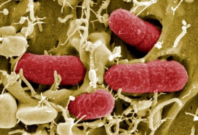 Première victime du Coronavirus en France